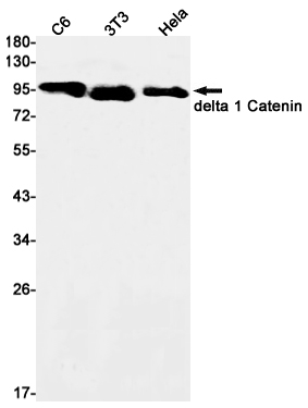 Western blot detection of delta 1 Catenin in C6,3T3,Hela cell lysates using delta 1 Catenin Rabbit mAb(1:1000 diluted).Predicted band size:108kDa.Observed band size:108kDa.
