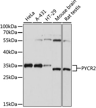 Western blot - PYCR2 Polyclonal Antibody 