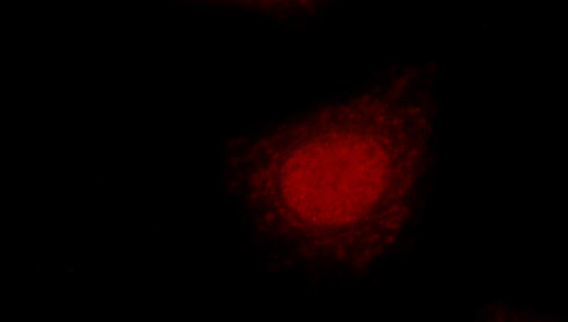 Immunofluorescent analysis of HepG2 cells using Catalog No:110866(GAR1 Antibody) at dilution of 1:25 and Rhodamine-Goat anti-Rabbit IgG