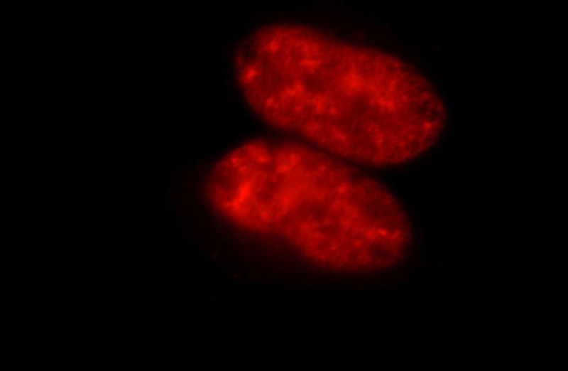 Immunofluorescent analysis of 293 cells, using SR140 antibody Catalog No:115660 at 1:25 dilution and Rhodamine-labeled goat anti-rabbit IgG (red).