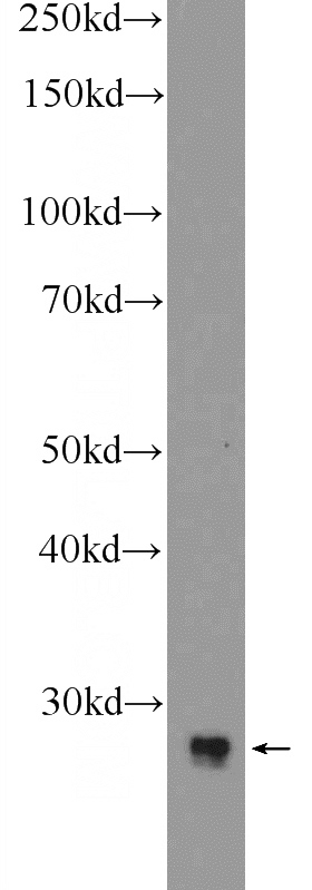 Y79 cells were subjected to SDS PAGE followed by western blot with Catalog No:112453(MAGEH1 Antibody) at dilution of 1:600