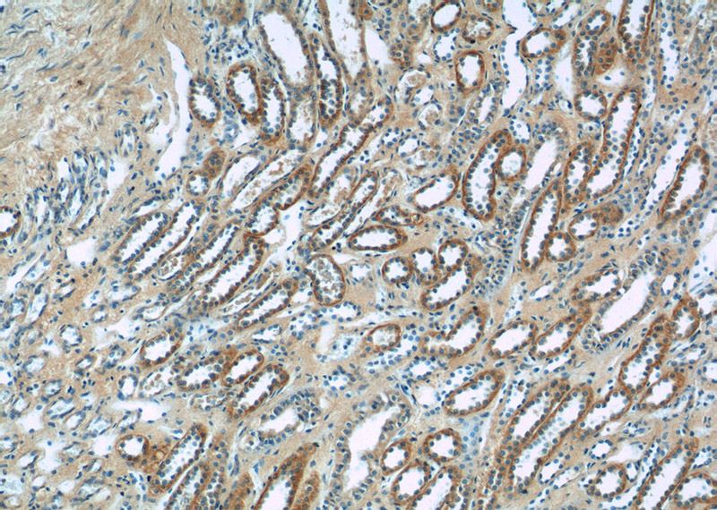 Immunohistochemistry of paraffin-embedded human kidney tissue slide using Catalog No:115613(SSTR2 Antibody) at dilution of 1:50 (under 10x lens)