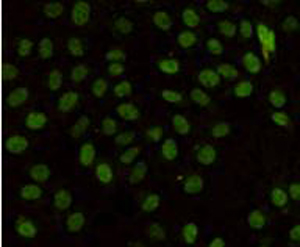 Immunocytochemistry staining of HeLa cells fixed in 1% Paraformaldehyde and using MLH1 mouse mAb (dilution 1:100).