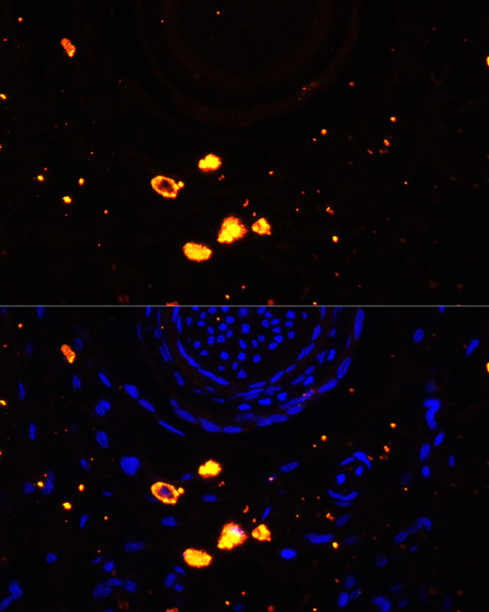 Immunofluorescence - TYR Polyclonal Antibody 