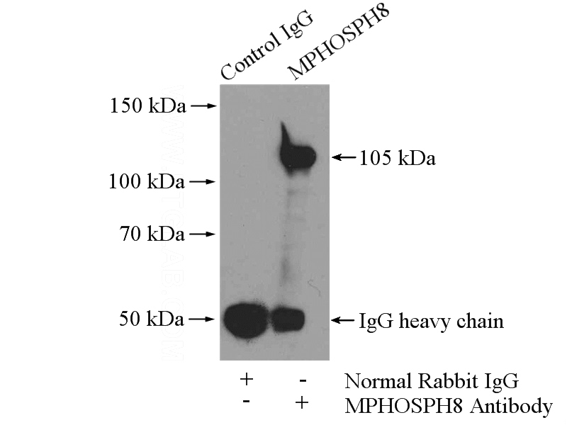IP Result of anti-MPHOSPH8 (IP:Catalog No:112752, 4ug; Detection:Catalog No:112752 1:1000) with mouse brain tissue lysate 4000ug.