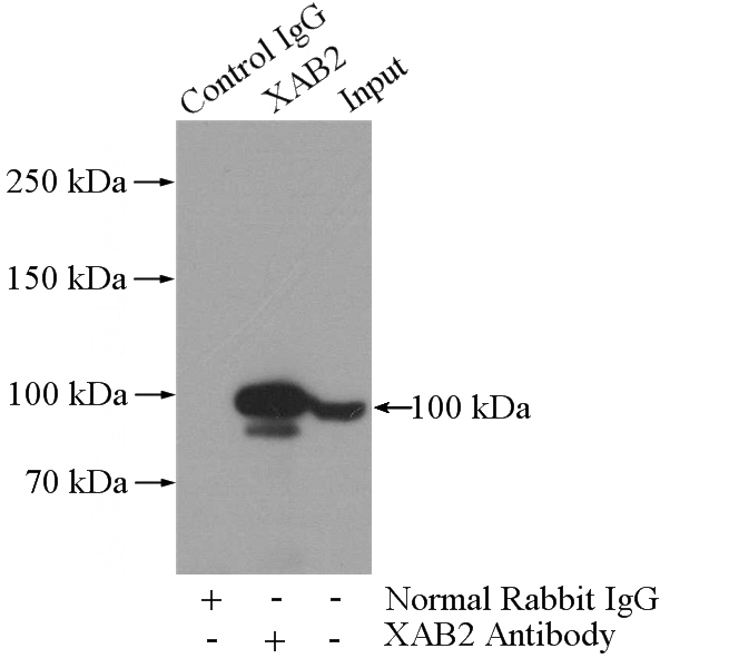 IP Result of anti-XAB2 (IP:Catalog No:116980, 4ug; Detection:Catalog No:116980 1:200) with K-562 cells lysate 3200ug.