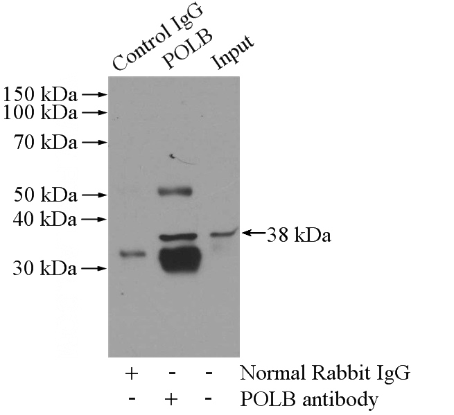 IP Result of anti-POLB (IP:Catalog No:110078, 4ug; Detection:Catalog No:110078 1:800) with K-562 cells lysate 3200ug.