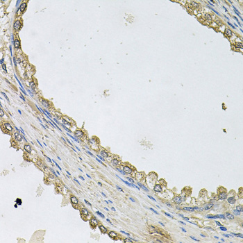 Immunohistochemistry - MTERFD1 Polyclonal Antibody 