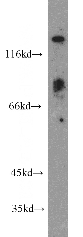 Human brain lysate were subjected to SDS PAGE followed by western blot with Catalog No:107424(MGEA5 antibody) at dilution of 1:600