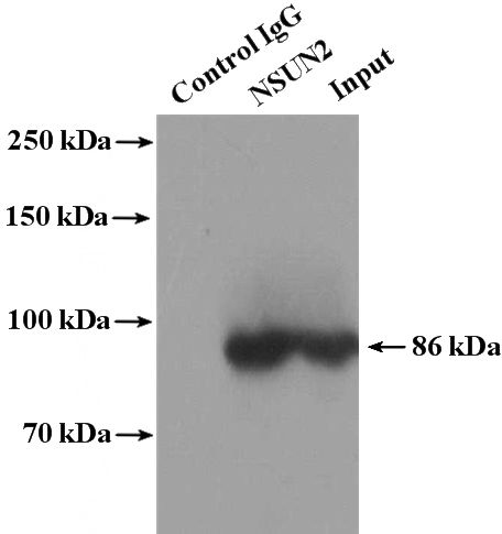 IP Result of anti-NSUN2 (IP:Catalog No:113388, 4ug; Detection:Catalog No:113388 1:1000) with HeLa cells lysate 4000ug.
