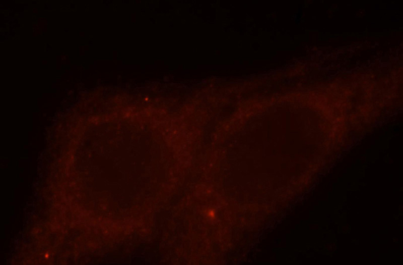 Immunofluorescent analysis of HepG2 cells, using DLC1 antibody Catalog No:109986 at 1:25 dilution and Rhodamine-labeled goat anti-rabbit IgG (red).