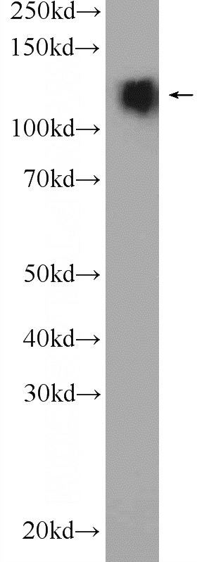 mouse brain tissue were subjected to SDS PAGE followed by western blot with Catalog No:109393(CLIP2 Antibody) at dilution of 1:3000