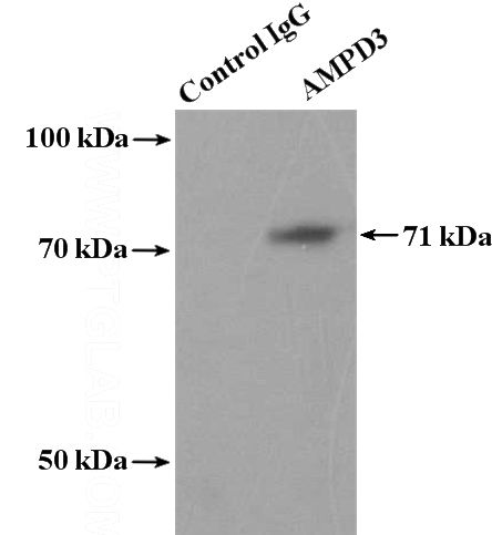 IP Result of anti-AMPD3 (IP:Catalog No:108003, 4ug; Detection:Catalog No:108003 1:800) with mouse kidney tissue lysate 4800ug.