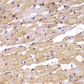 Immunohistochemistry - PSEN2 Polyclonal Antibody 