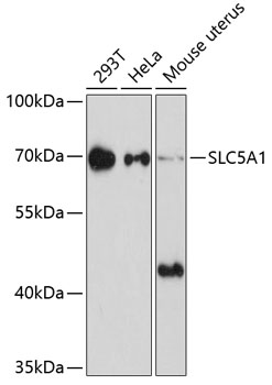 Western blot - SLC5A1 Polyclonal Antibody 