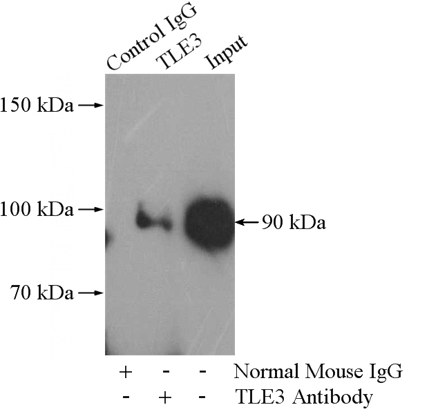 IP Result of anti-TLE3 (IP:Catalog No:107626, 5ug; Detection:Catalog No:107626 1:500) with HEK-293 cells lysate 1480ug.