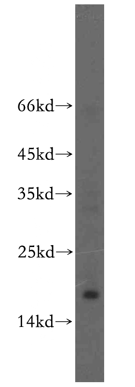 mouse liver tissue were subjected to SDS PAGE followed by western blot with Catalog No:116696(UTP23 antibody) at dilution of 1:1000