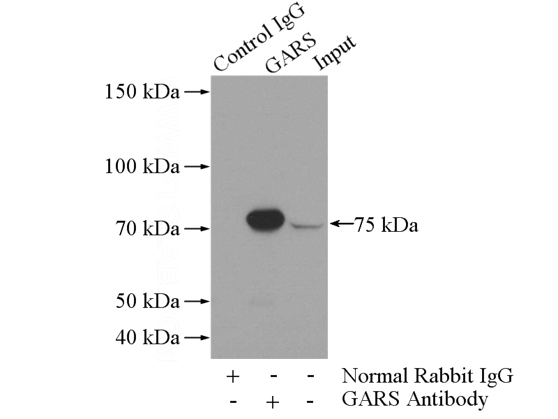 IP Result of anti-GARS (IP:Catalog No:110867, 4ug; Detection:Catalog No:110867 1:500) with mouse liver tissue lysate 4000ug.