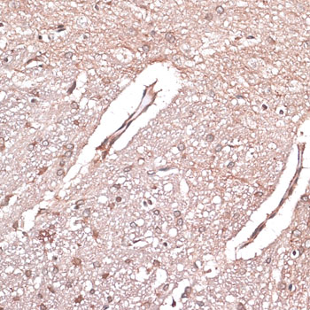 Immunohistochemistry - LMO4 Polyclonal Antibody 