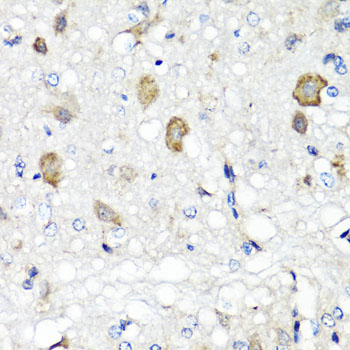 Immunohistochemistry - RBP2 Polyclonal Antibody 