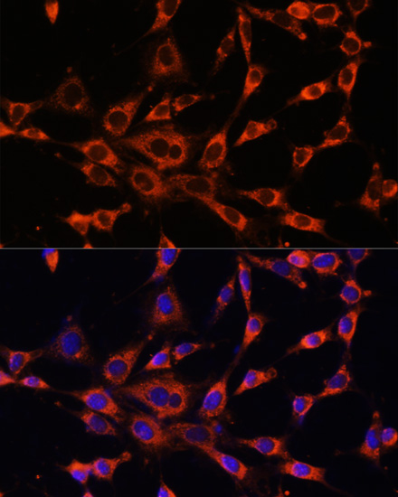 Immunofluorescence - ITPR3 Polyclonal Antibody 