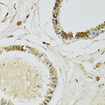 Immunohistochemistry - KLK10 Polyclonal Antibody 