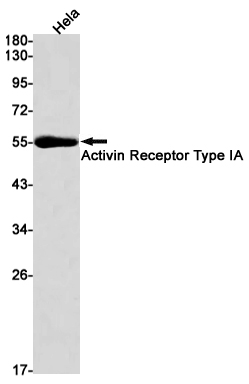 Western blot detection of Activin Receptor Type IA in Hela cell lysates using Activin Receptor Type IA Rabbit mAb(1:1000 diluted).Predicted band size:57kDa.Observed band size:57kDa.
