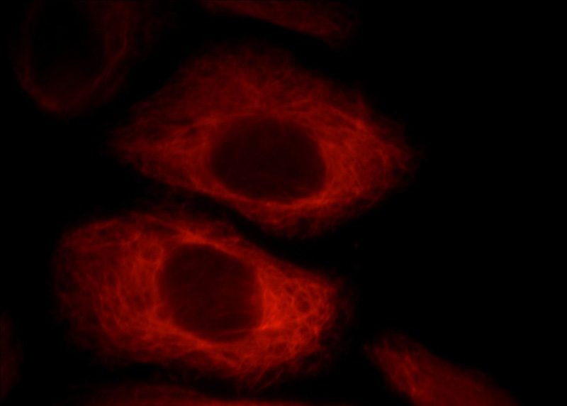 Immunofluorescent analysis of HepG2 cells, using VIL1 antibody Catalog No: at 1:25 dilution and Rhodamine-labeled goat anti-mouse IgG (red).