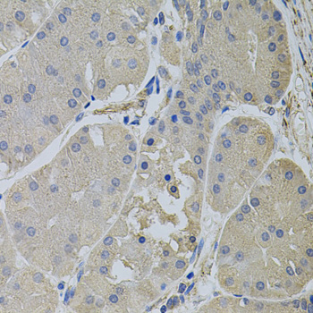 Immunohistochemistry - CLTC Polyclonal Antibody 