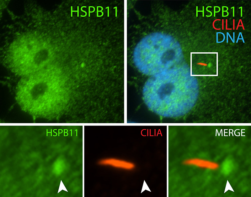 IF result (the base of cilia stain) of anti-HSPB11 (IFT25, Catalog No:111666, 1:50) with serum-starved hTERT-RPE1 (PFA fixed) by Dr. Moshe Kim.