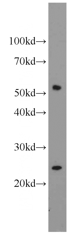 Jurkat cells were subjected to SDS PAGE followed by western blot with Catalog No:109576(CROP antibody) at dilution of 1:600