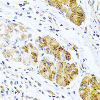 Immunohistochemistry - CCL8 Polyclonal Antibody 