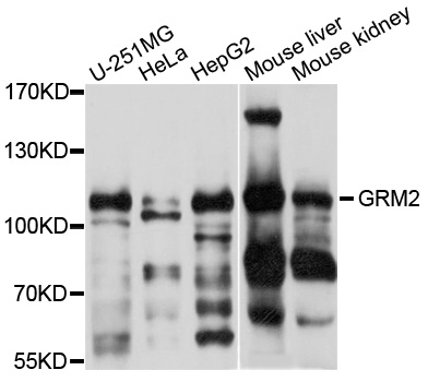Western blot - GRM2 Polyclonal Antibody 