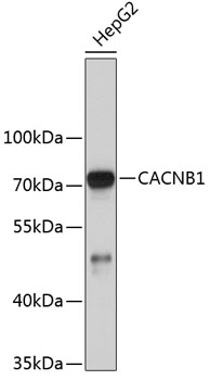 Western blot - CACNB1 Polyclonal Antibody 