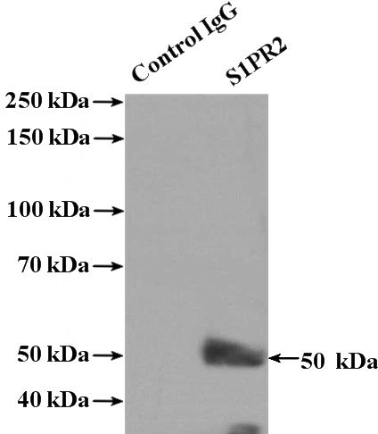 IP Result of anti-S1PR2 (IP:Catalog No:114969, 4ug; Detection:Catalog No:114969 1:300) with MCF-7 cells lysate 1320ug.