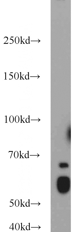 HeLa cells were subjected to SDS PAGE followed by western blot with Catalog No:112081(KLF4 antibody) at dilution of 1:1000