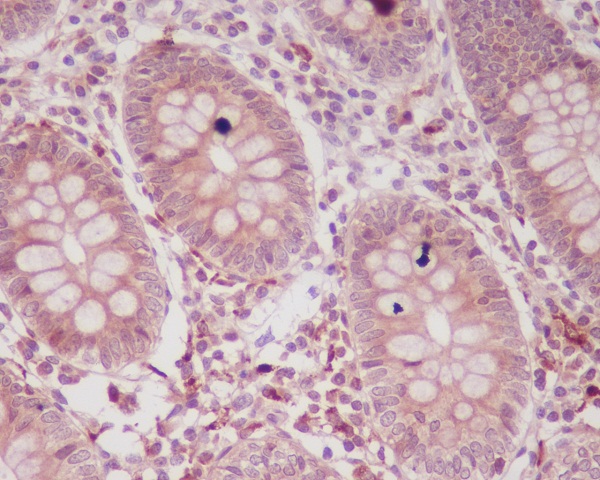 Immunohistochemical analysis of p16 ARC in paraffin-embedded human colon tissue using p16 ARC Antibody at dilution 1/50.