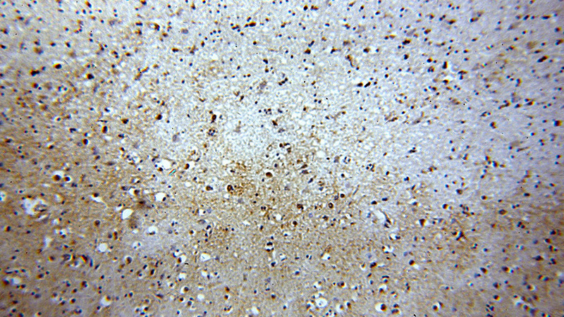 Immunohistochemical of paraffin-embedded human brain using Catalog No:113012(NAB2 antibody) at dilution of 1:100 (under 10x lens)
