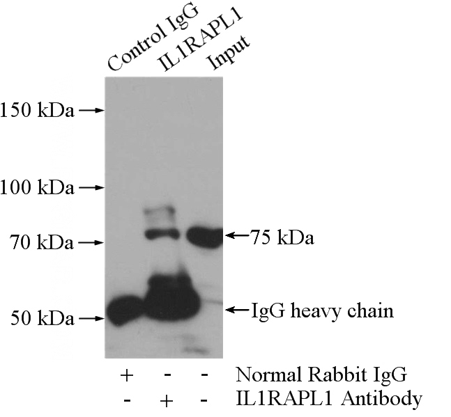 IP Result of anti-IL1RAPL1 (IP:Catalog No:111773, 4ug; Detection:Catalog No:111773 1:300) with mouse heart tissue lysate 4000ug.