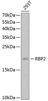 Western blot - RBP2 Polyclonal Antibody 