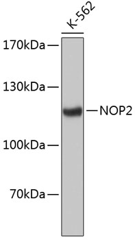 Western blot - NOP2 Polyclonal Antibody 