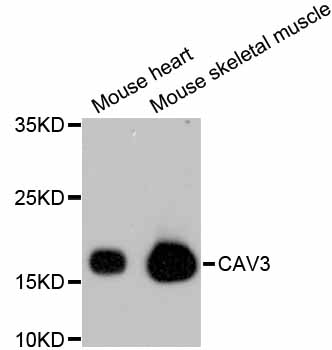 Western blot - CAV3 Monoclonal Antibody 