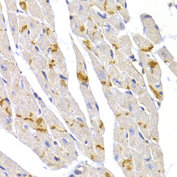 Immunohistochemistry - DSP Polyclonal Antibody 