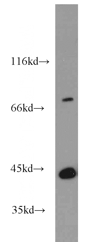 human brain tissue were subjected to SDS PAGE followed by western blot with Catalog No:112744(MPI antibody) at dilution of 1:1200