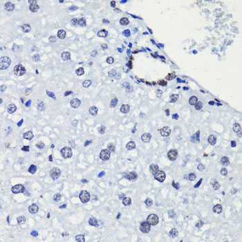 Immunohistochemistry - Acetyl-Histone H2A-K5 pAb 