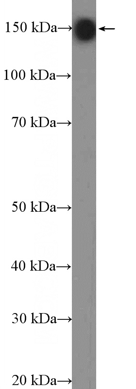 rat brain tissue were subjected to SDS PAGE followed by western blot with Catalog No:108841(CADPS Antibody) at dilution of 1:600