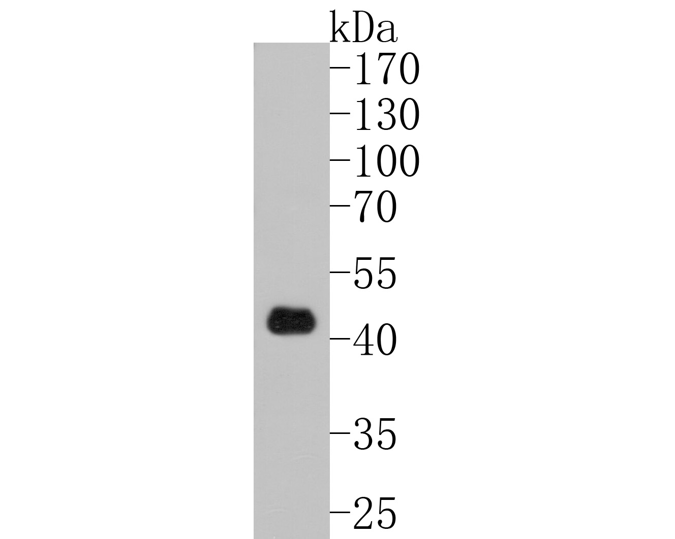Fig2:; Western blot analysis of MATH1 on mouse brain tissue lysates. Proteins were transferred to a PVDF membrane and blocked with 5% NFDM/TBST for 1 hour at room temperature. The primary antibody ( 1/500) was used in 5% NFDM/TBST at room temperature for 2 hours. Goat Anti-Rabbit IgG - HRP Secondary Antibody (HA1001) at 1:200,000 dilution was used for 1 hour at room temperature.