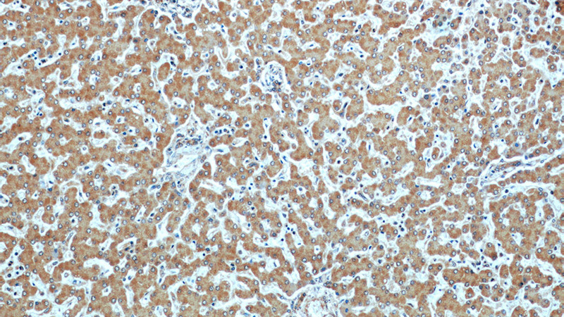 Immunohistochemical of paraffin-embedded human liver using Catalog No:107526(SERPINA10 antibody) at dilution of 1:50 (under 10x lens)
