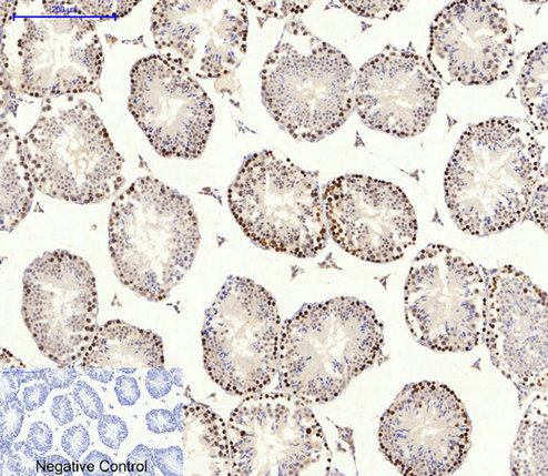 Immunohistochemical analysis of paraffin-embedded Mouse-testis tissue. 1,AMPKα1/2 Polyclonal Antibody was diluted at 1:200(4°C,overnight). 2, Sodium citrate pH 6.0 was used for antibody retrieval(>98°C,20min). 3,Secondary antibody was diluted at 1:200(room tempeRature, 30min). Negative control was used by secondary antibody only.