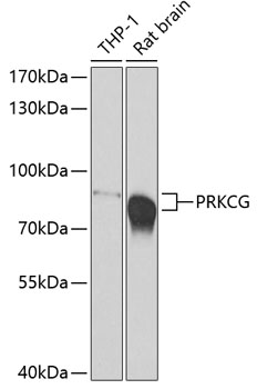 Western blot - PRKCG Polyclonal Antibody 